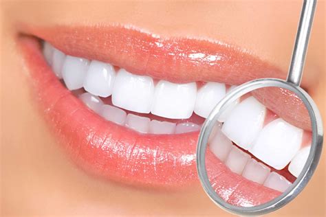 bright now teeth whitening|Cosmetic Dentist 